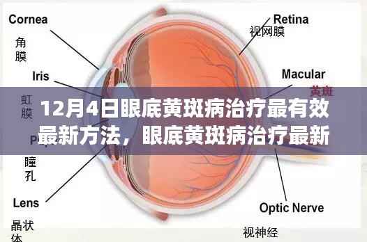 眼底黄斑病治疗最新方法深度探讨与观点阐述，有效治疗策略分析